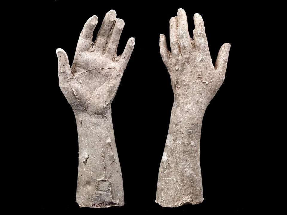 Plaster cast of an unidentified woman's left hand and forearm